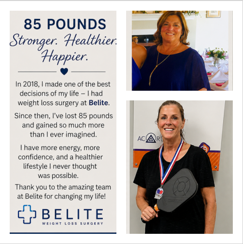 Patricia B.  Gastric Sleeve Update After 8 Years*